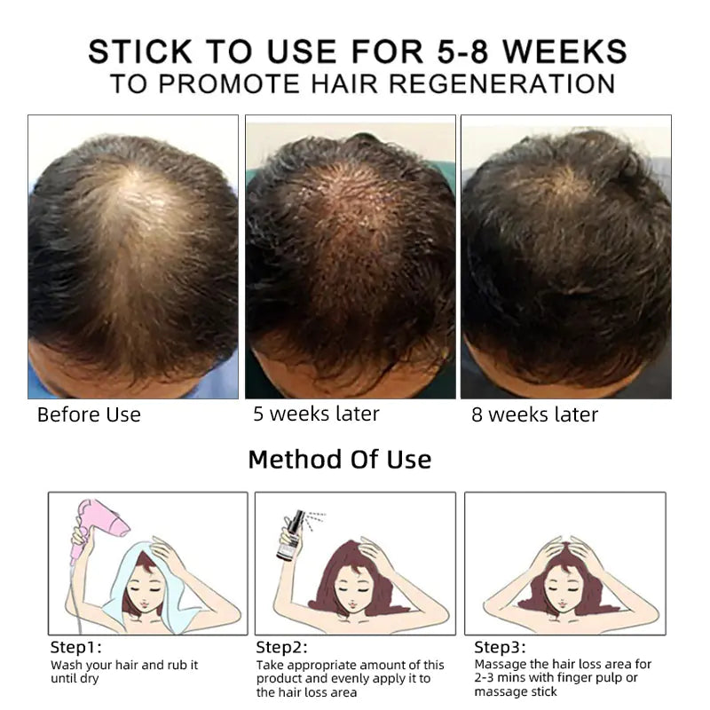 Hair Essence and Anti-Hair Loss Serum for Care