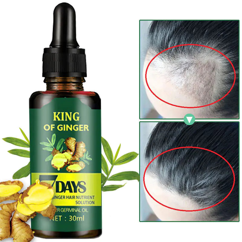 Ginger Hair Growth Oil for Hair Loss Prevention