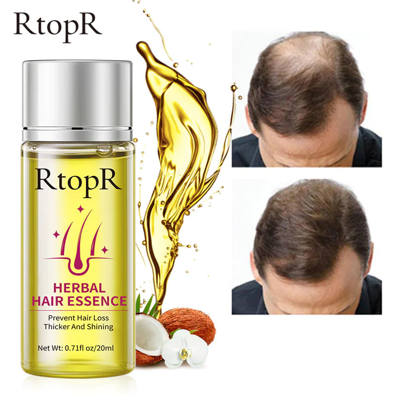 RtopR Herbal Hair Oil for Hair Growth and Nourishment
