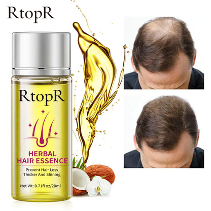 RtopR Herbal Hair Oil for Hair Growth and Nourishment